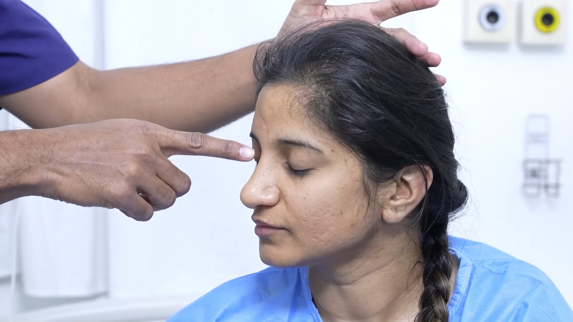 Revision rhinoplasty for a broad girl